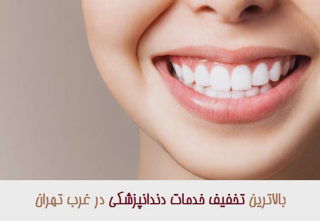تخفیف خدمات دندانپزشکی در غرب تهران