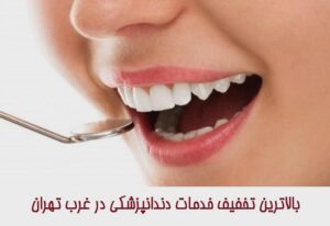  تخفیف خدمات دندانپزشکی در غرب تهران