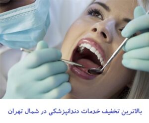  تخفیف خدمات دندانپزشکی در شمال تهران