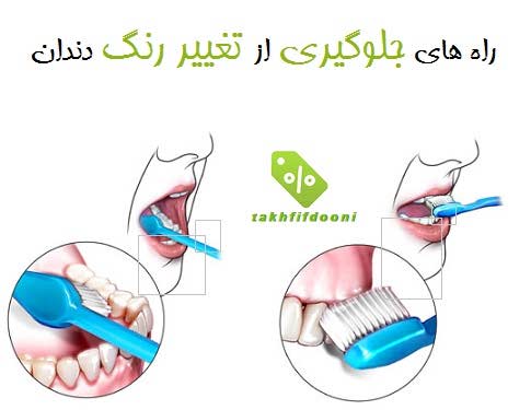 راه های جلوگیری از تغییر رنگ دندان