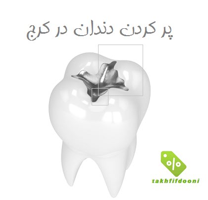 پر کردن دندان در کرج
